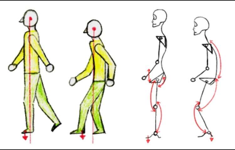 ストレートネック